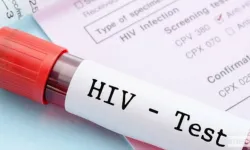 HIV Tedavisinde Umut Vadeden Araştırma