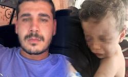 Türkiye Bu Vahşeti Konuşuyor... 2 Yaşındaki Bebeği Isırdı, Yakmaya Çalıştı: İfadesi Kan Dondurdu!