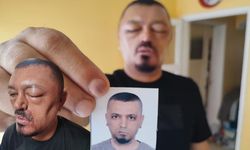 Adana’da Kozmetik Kabusu! Saçlarını Siyah Yapmak İsterken Başına Gelenler Şok Etti