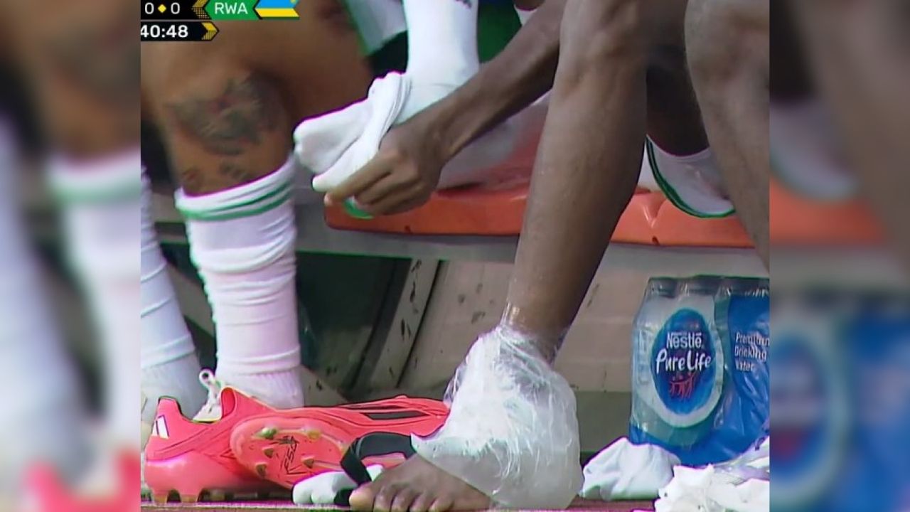 Victor Osimhen Sakatlik Kac Gun